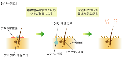 わきが・多汗症のメカニズム