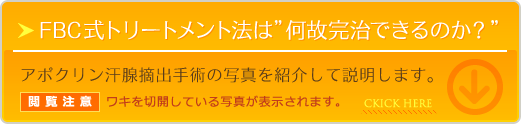 アポクリン汗腺摘出